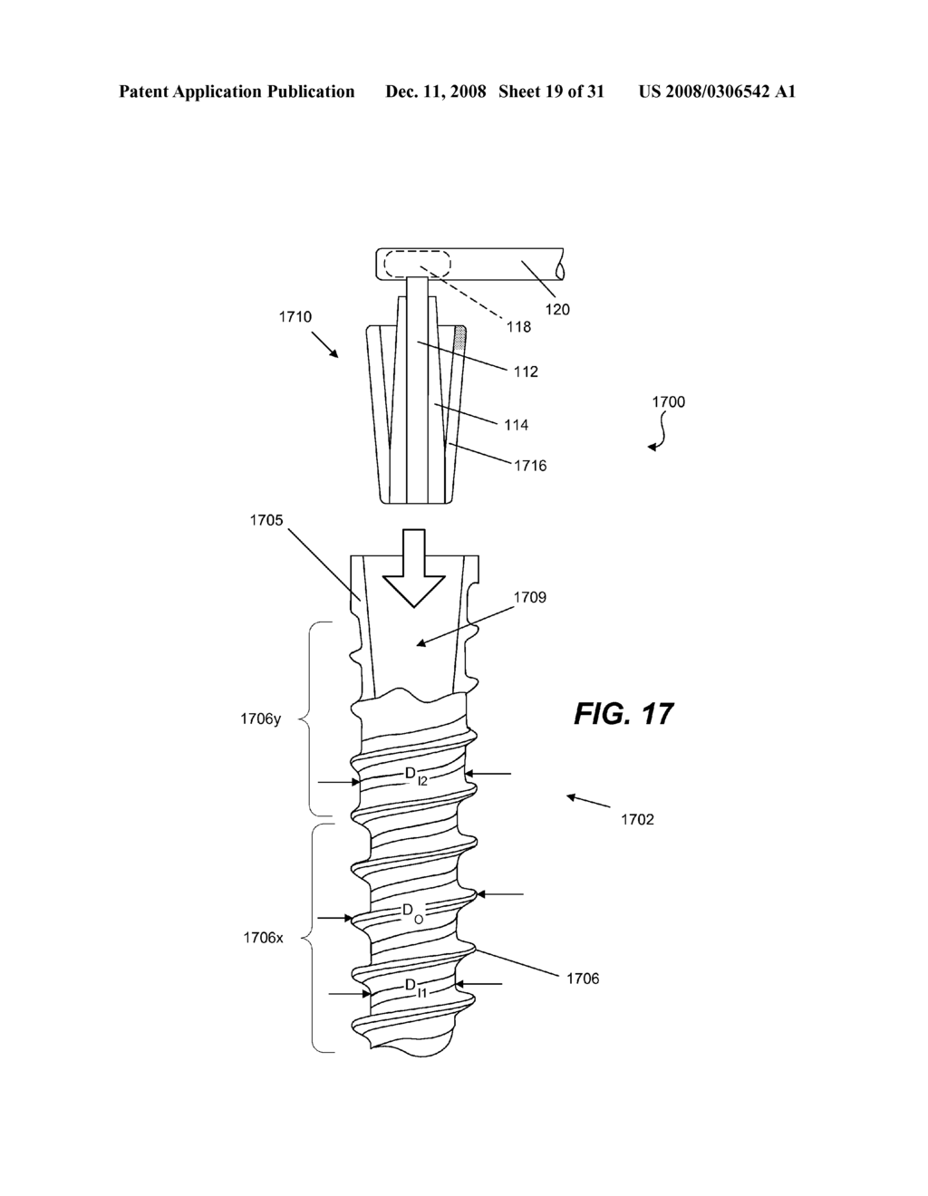 SPINE IMPLANT WITH A DEFLECTION ROD SYSTEM AND CONNECTING LINKAGES AND METHOD - diagram, schematic, and image 20