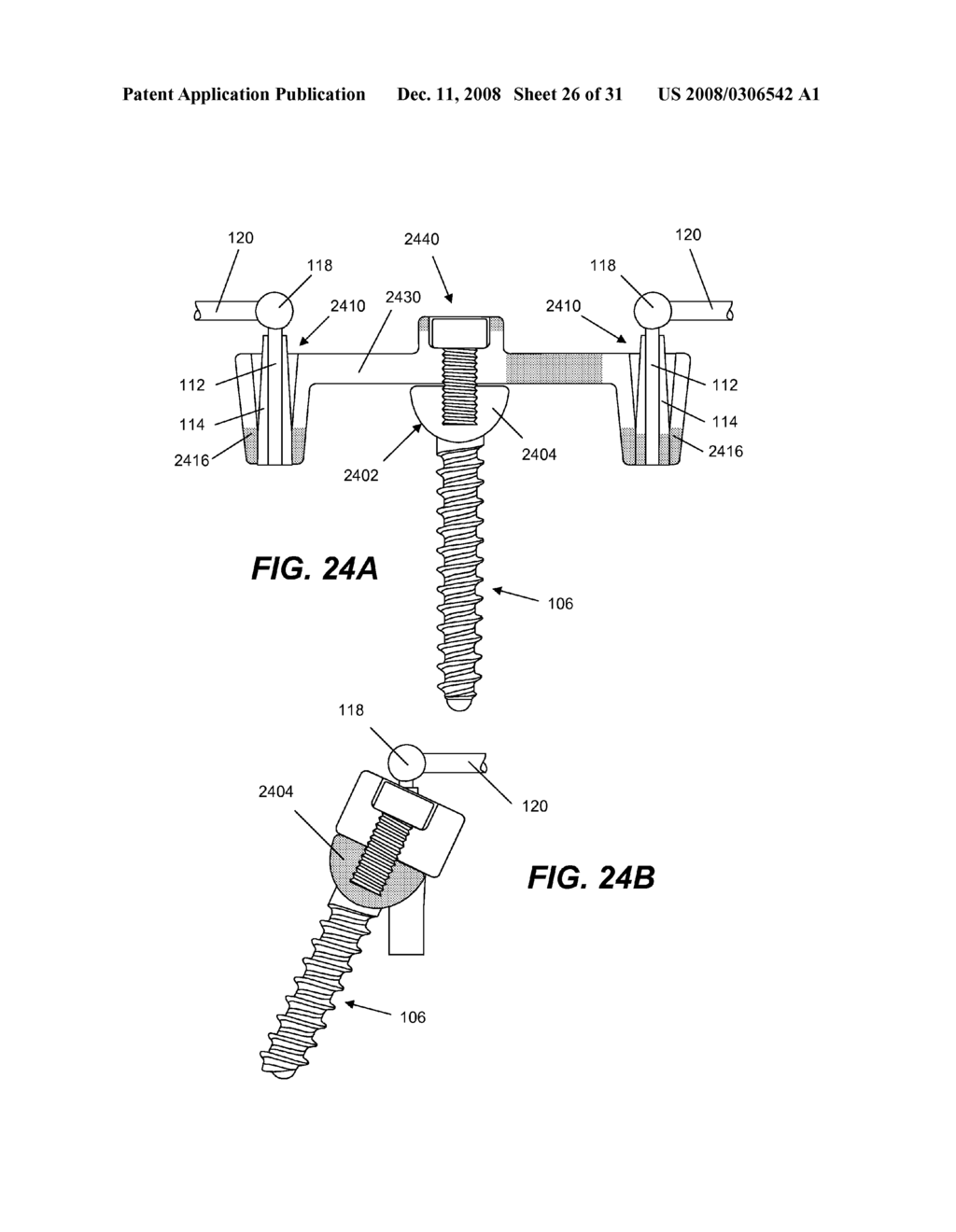 SPINE IMPLANT WITH A DEFLECTION ROD SYSTEM AND CONNECTING LINKAGES AND METHOD - diagram, schematic, and image 27