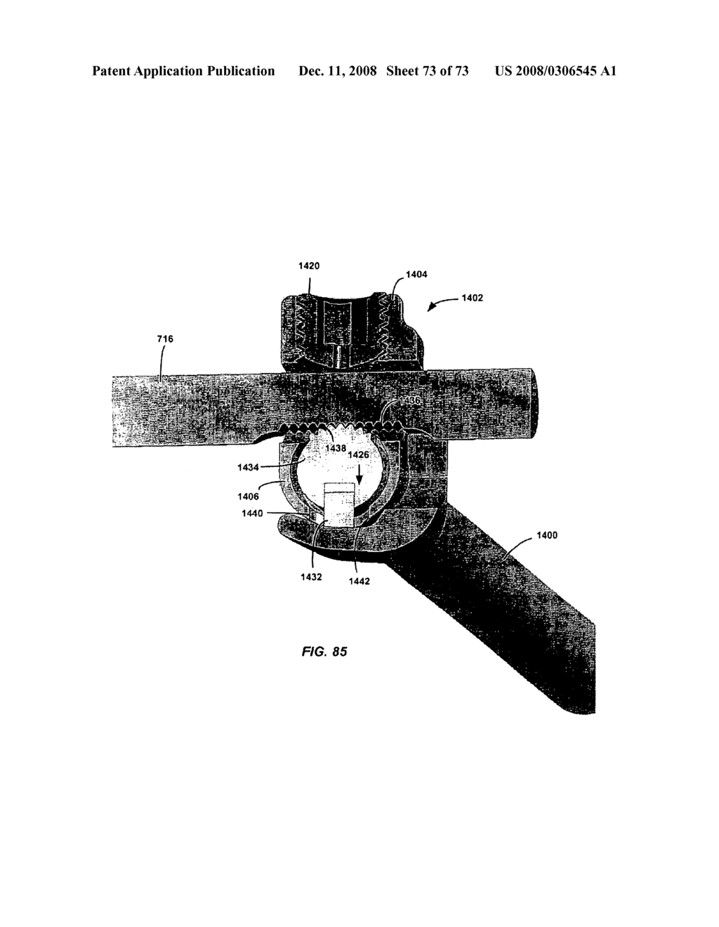 DEFLECTION ROD SYSTEM FOR A DYNAMIC STABILIZATION AND MOTION PRESERVATION SPINAL IMPLANTATION SYSTEM AND METHOD - diagram, schematic, and image 74