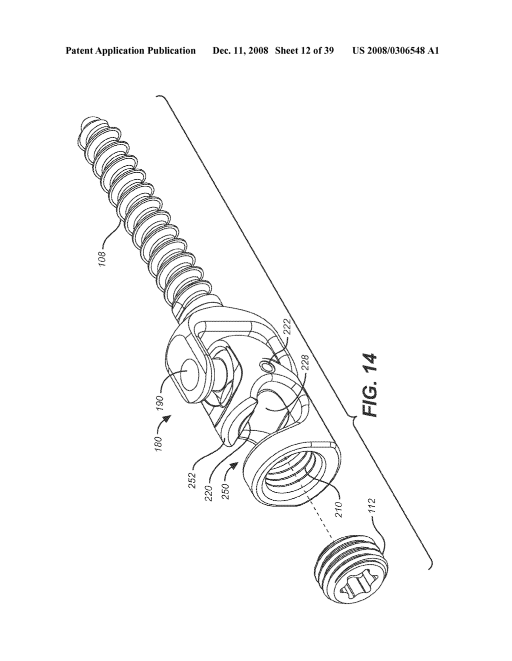 DYNAMIC STABILIZATION AND MOTION PRESERVATION SPINAL IMPLANTATION SYSTEM AND METHOD - diagram, schematic, and image 13