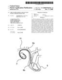 Implantable Medical Device with Heart Condition Detection diagram and image