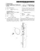 Shoulder prosthesis diagram and image