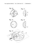 Shoulder prosthesis diagram and image