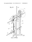 Shoulder prosthesis diagram and image