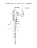 Shoulder prosthesis diagram and image