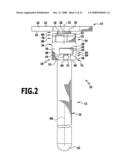 Modular implant part and knee joint prosthesis diagram and image