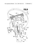 Modular implant part and knee joint prosthesis diagram and image