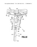 Modular implant part and knee joint prosthesis diagram and image