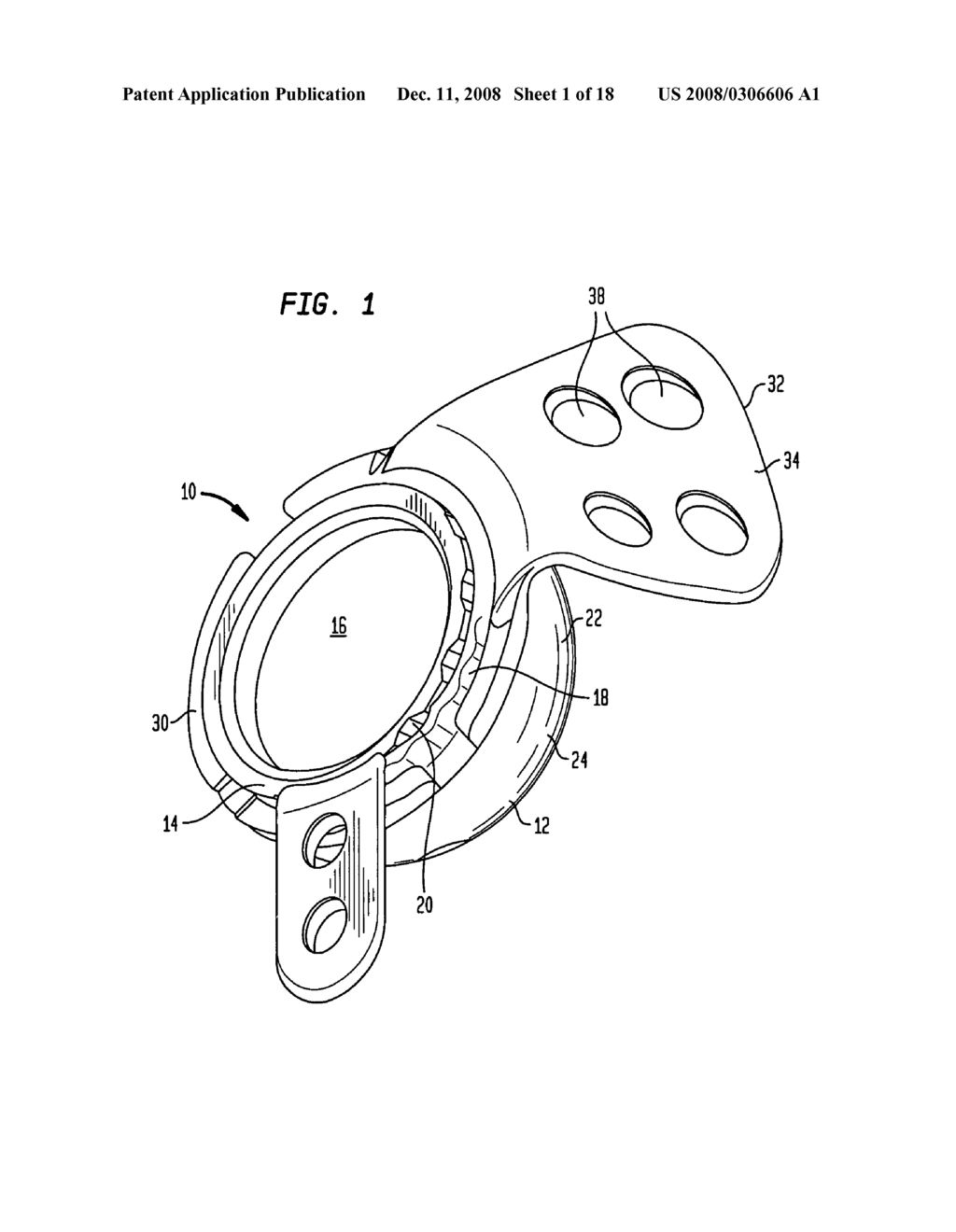 Acetabular shell - diagram, schematic, and image 02