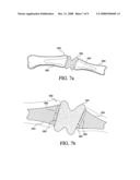 Fixation of Elastomer to Rigid Structures diagram and image