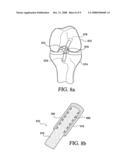 Fixation of Elastomer to Rigid Structures diagram and image