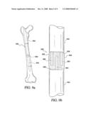 Fixation of Elastomer to Rigid Structures diagram and image