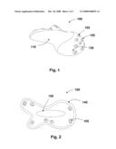 FLOATING ISLAND diagram and image