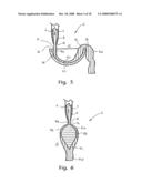 Dispensing Device for Reducing Loss of Dissolved Gas in a Liquid Outflow and a Method of Using Same diagram and image