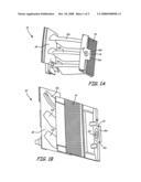 Method of determining depth of intergranular attack (IGA) for a metal part diagram and image