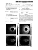 PATTERN ANALYSIS OF RETINAL MAPS FOR THE DIAGNOSIS OF OPTIC NERVE DISEASES BY OPTICAL COHERENCE TOMOGRAPHY diagram and image