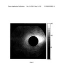 PATTERN ANALYSIS OF RETINAL MAPS FOR THE DIAGNOSIS OF OPTIC NERVE DISEASES BY OPTICAL COHERENCE TOMOGRAPHY diagram and image