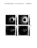 PATTERN ANALYSIS OF RETINAL MAPS FOR THE DIAGNOSIS OF OPTIC NERVE DISEASES BY OPTICAL COHERENCE TOMOGRAPHY diagram and image