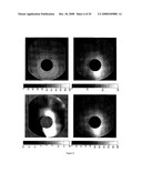 PATTERN ANALYSIS OF RETINAL MAPS FOR THE DIAGNOSIS OF OPTIC NERVE DISEASES BY OPTICAL COHERENCE TOMOGRAPHY diagram and image