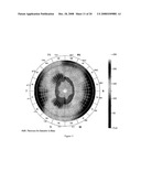 PATTERN ANALYSIS OF RETINAL MAPS FOR THE DIAGNOSIS OF OPTIC NERVE DISEASES BY OPTICAL COHERENCE TOMOGRAPHY diagram and image