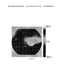 PATTERN ANALYSIS OF RETINAL MAPS FOR THE DIAGNOSIS OF OPTIC NERVE DISEASES BY OPTICAL COHERENCE TOMOGRAPHY diagram and image