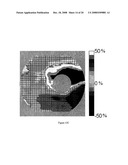 PATTERN ANALYSIS OF RETINAL MAPS FOR THE DIAGNOSIS OF OPTIC NERVE DISEASES BY OPTICAL COHERENCE TOMOGRAPHY diagram and image