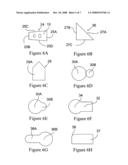 Disposable processing bag with alignment feature
 diagram and image