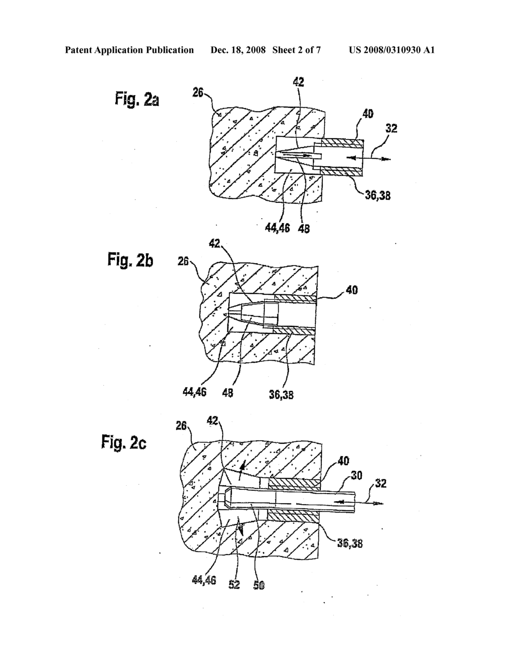 Method, Anchor and Drill for Anchoring the Anchor in an Anchoring Substrate - diagram, schematic, and image 03