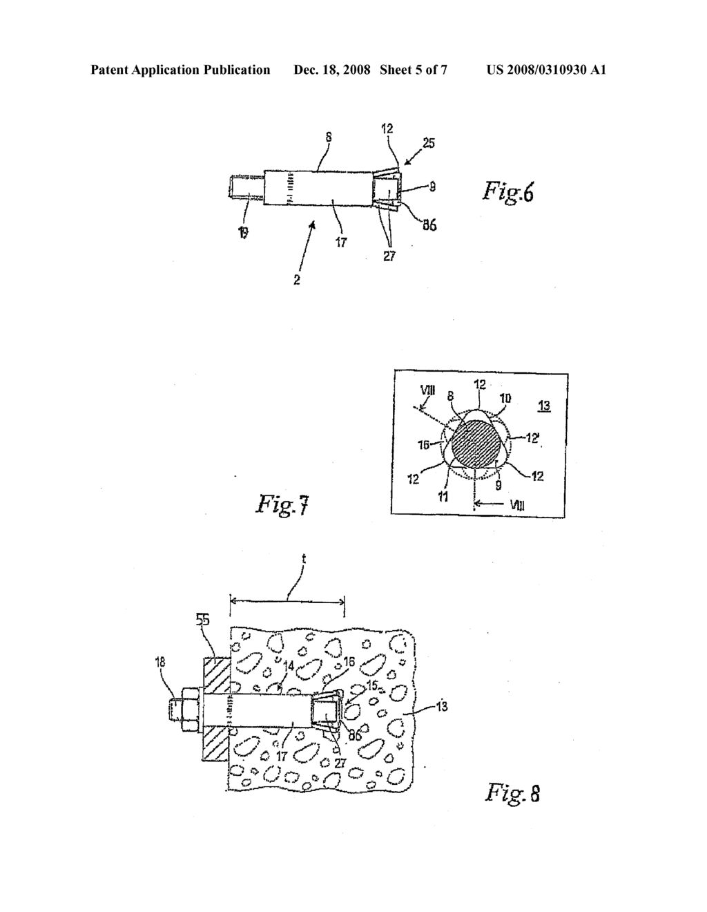 Method, Anchor and Drill for Anchoring the Anchor in an Anchoring Substrate - diagram, schematic, and image 06