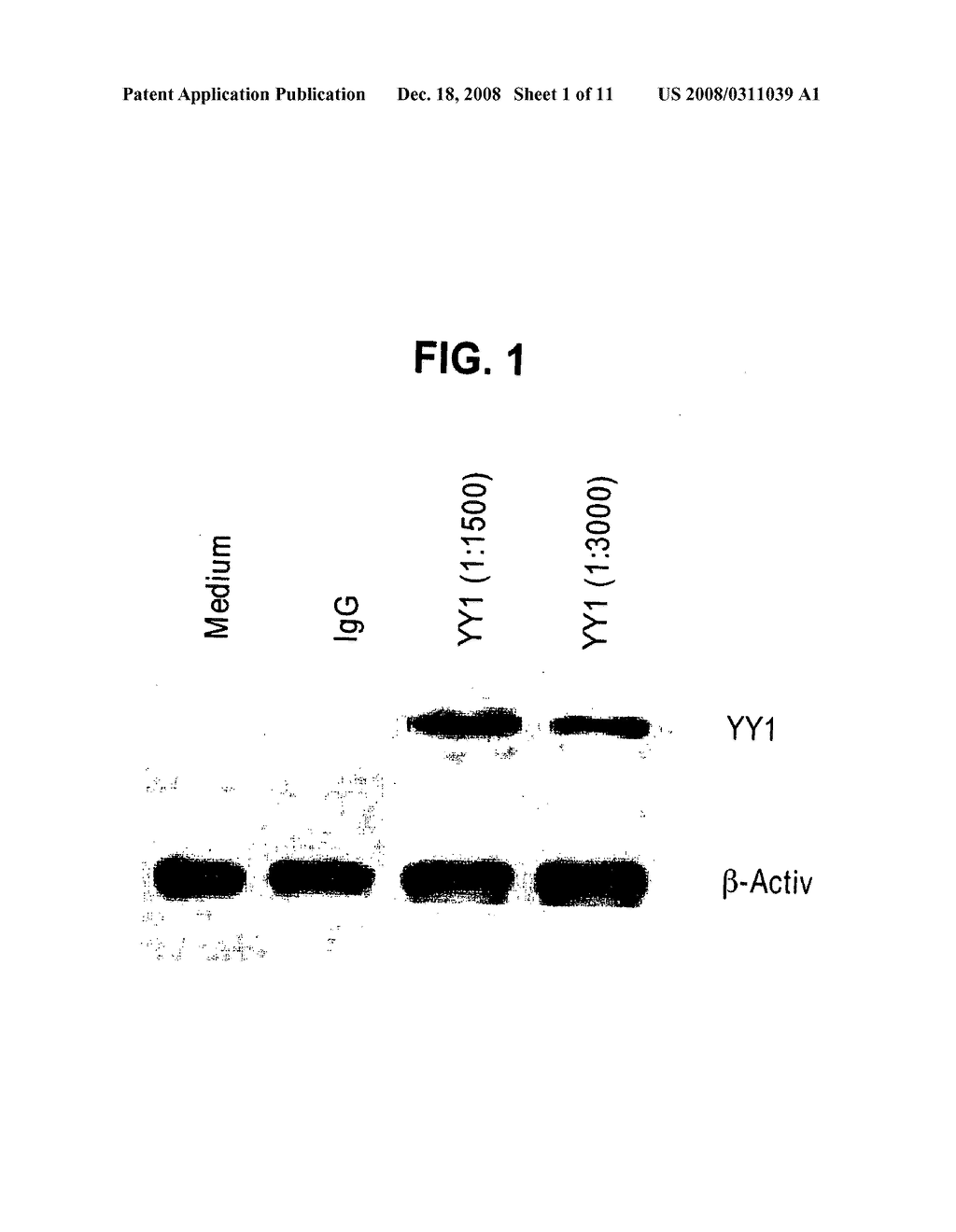 Therapeutic and Prognostic Factor Yy1 in Human Cancer - diagram, schematic, and image 02