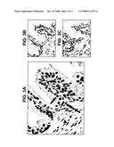 Therapeutic and Prognostic Factor Yy1 in Human Cancer diagram and image