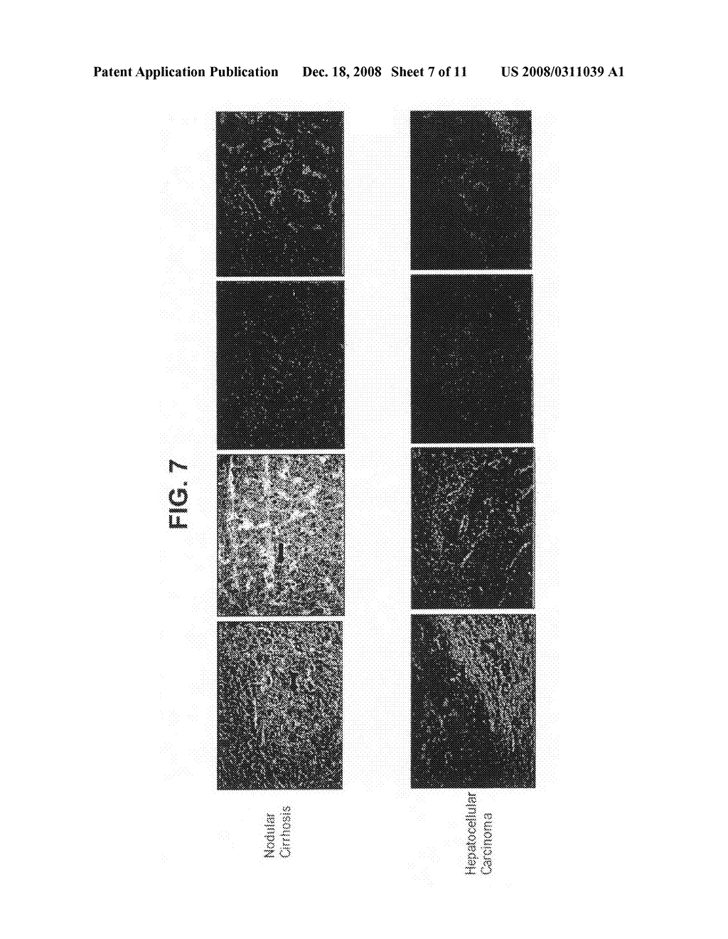 Therapeutic and Prognostic Factor Yy1 in Human Cancer - diagram, schematic, and image 08