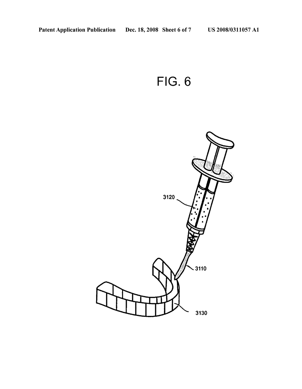 Bleaching Toothpastes and Methods for Making and Using Them - diagram, schematic, and image 07