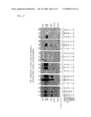 Process for the Determination of Inflammatory Process and Pharmaceutical Compositions for the Treatment Thereof diagram and image