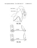 Torque Overcorrection Model diagram and image