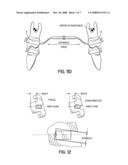 Torque Overcorrection Model diagram and image