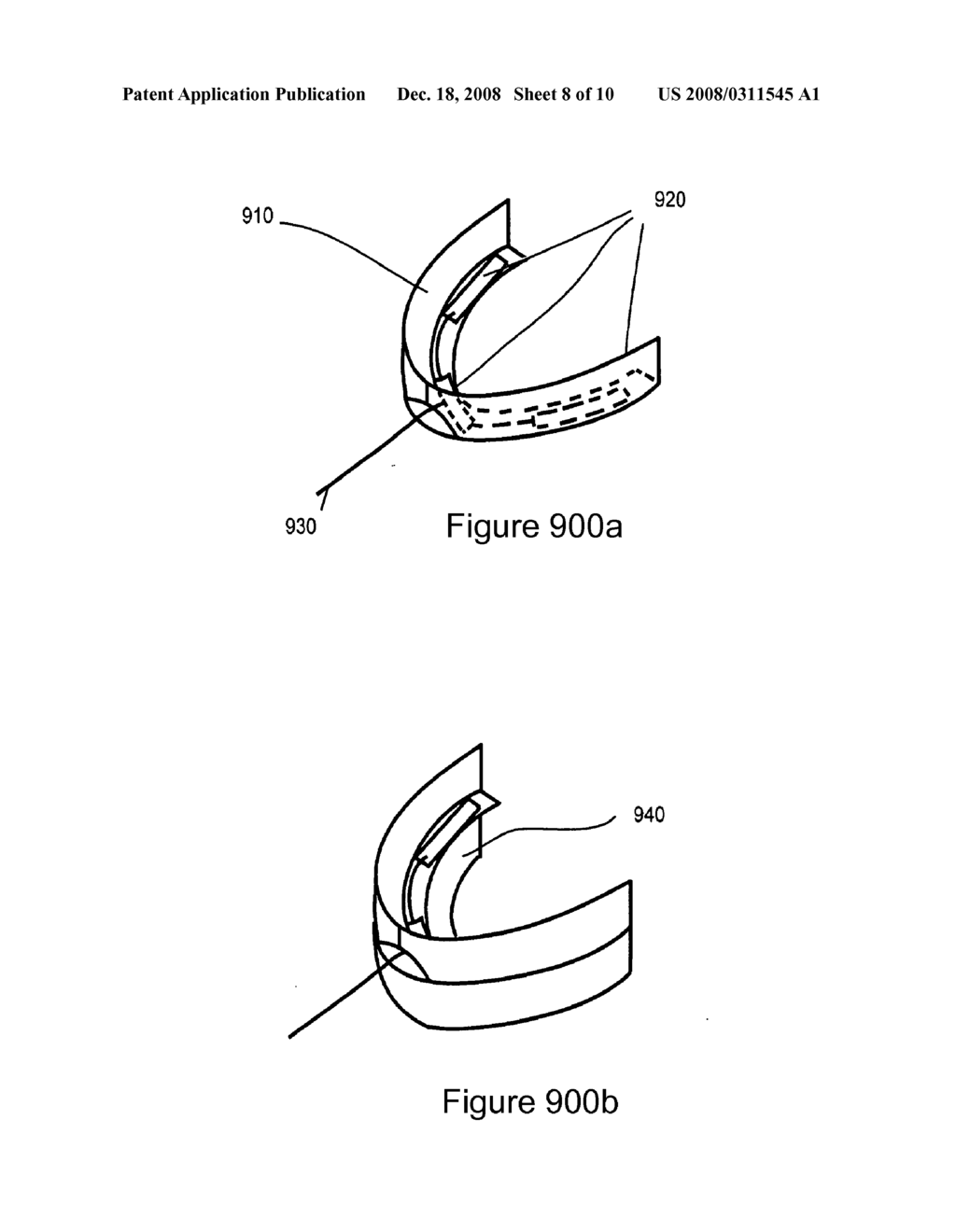 Systems and Methods for Utilizing Ultrasonic Energy to Activate Tooth Whitening Substances - diagram, schematic, and image 09