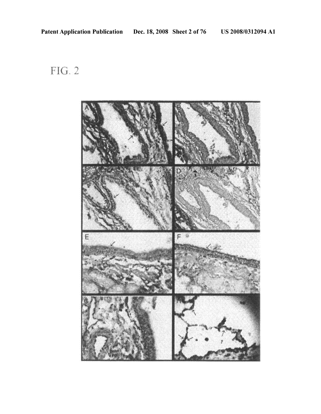 MUTATED AQP, METHOD FOR DETECTING CANCER USING THE SAME, DNA CHIP HAVING OLIGONUCLEOTIDES OF SAID MUTATED AQP SEQUENCE - diagram, schematic, and image 03