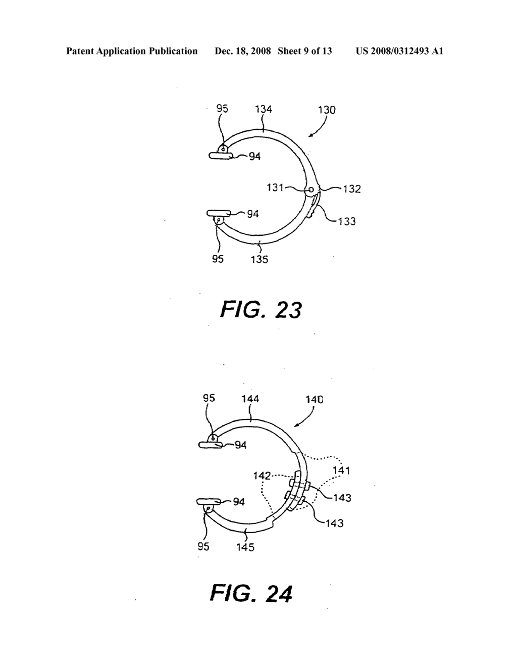 External stress reduction device and method - diagram, schematic, and image 10