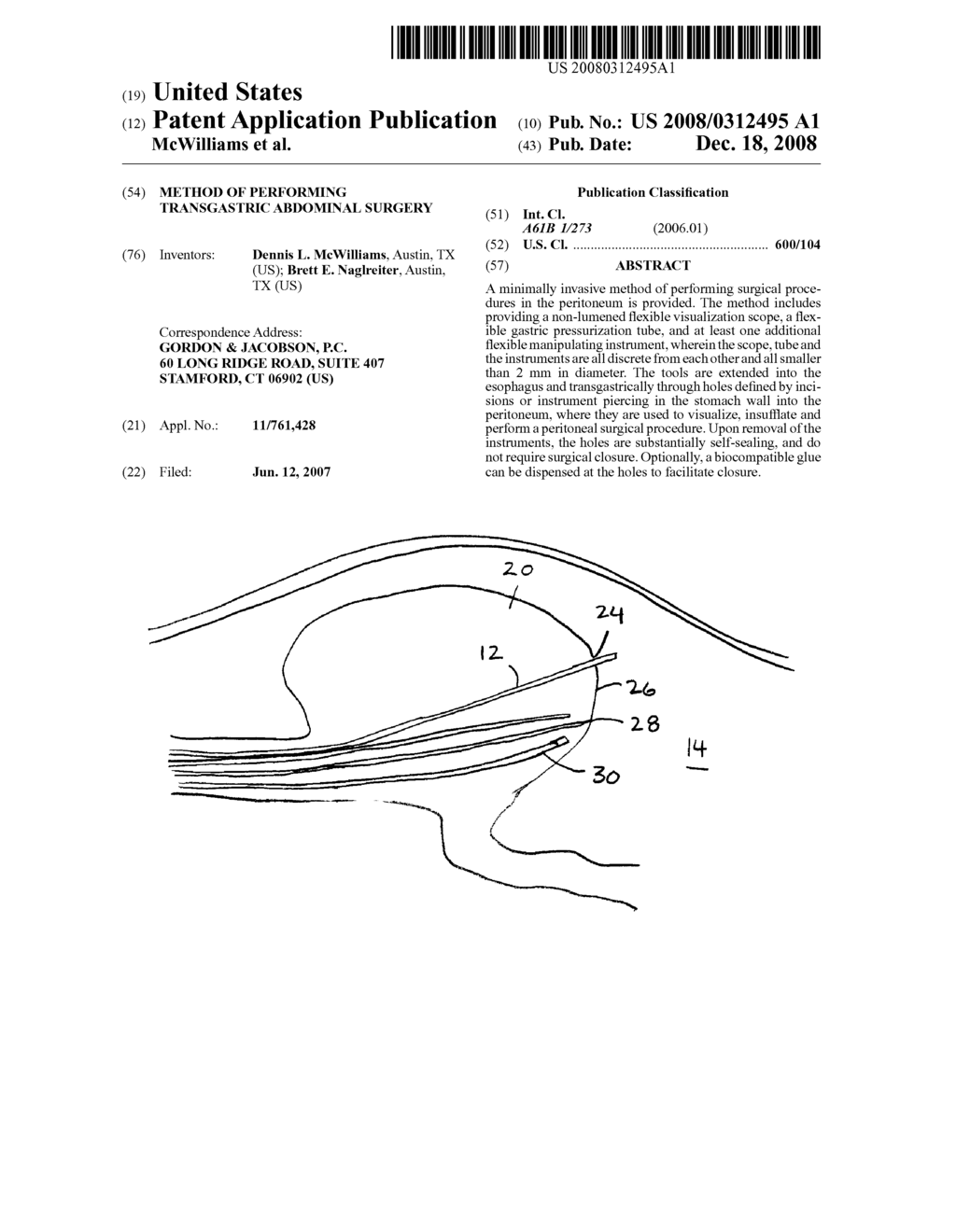 Method of Performing Transgastric Abdominal Surgery - diagram, schematic, and image 01