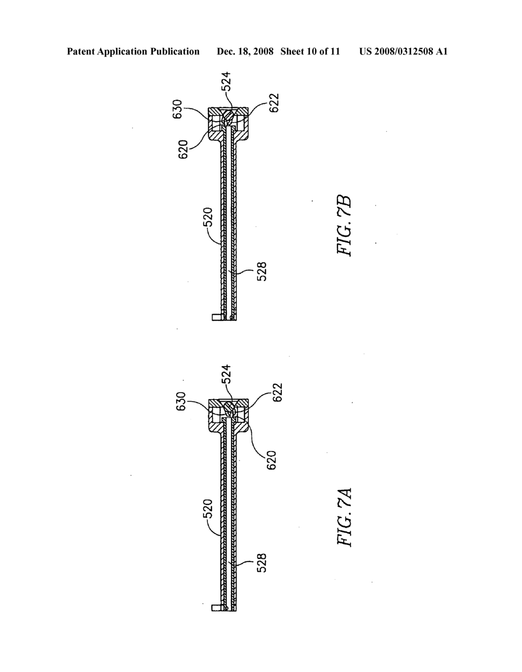 Vaginal Speculum Assembly - diagram, schematic, and image 11