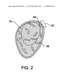 IMPLANTABLE MARKER FOR A SURGICAL NAVIGATION SYSTEM, THE MARKER HAVING A SPIKE FOR REMOVABLY SECURING THE MARKER TO THE TISSUE TO BE TRACKED diagram and image