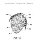 IMPLANTABLE MARKER FOR A SURGICAL NAVIGATION SYSTEM, THE MARKER HAVING A SPIKE FOR REMOVABLY SECURING THE MARKER TO THE TISSUE TO BE TRACKED diagram and image