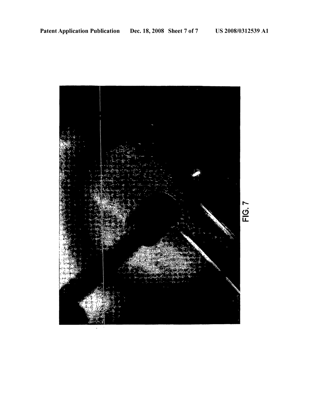 Methods of Using Optical Agents - diagram, schematic, and image 08