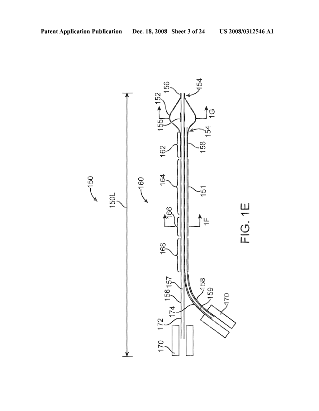 Systems and Methods for Needle Access to an Intervertebral Disc - diagram, schematic, and image 04