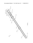 ANCHOR INSTRUMENTATION AND METHODS diagram and image