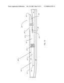 ANCHOR INSTRUMENTATION AND METHODS diagram and image