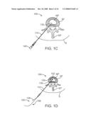 Systems and Methods for Needle Access to an Intervertebral Disc diagram and image