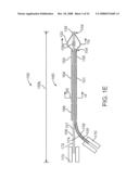 Systems and Methods for Needle Access to an Intervertebral Disc diagram and image