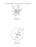 Systems and Methods for Needle Access to an Intervertebral Disc diagram and image